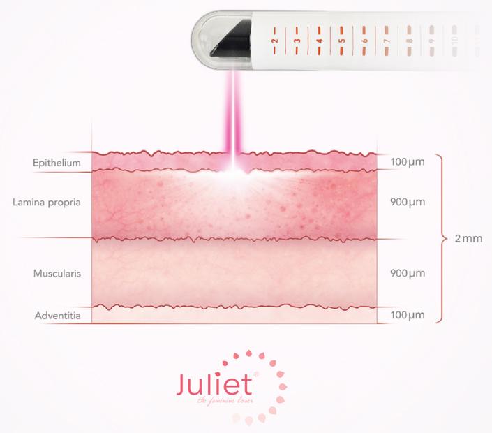 How Julliet works How Julliet works